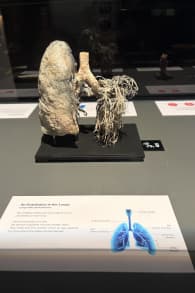 Photo 4 from BODY WORLDS: The Anatomy of Happiness