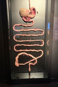 Photo 6 from BODY WORLDS: The Anatomy of Happiness