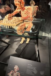 Photo 7 from BODY WORLDS: The Anatomy of Happiness