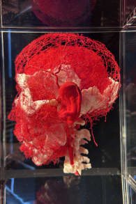 Photo 3 from BODY WORLDS: The Anatomy of Happiness