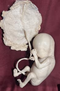 Photo 6 from BODY WORLDS: The Anatomy of Happiness