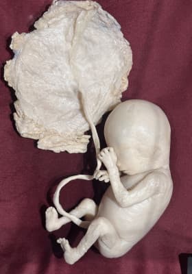 Photo 1 from The District Docklands