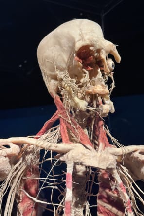 Photo 5 from BODY WORLDS: The Anatomy of Happiness