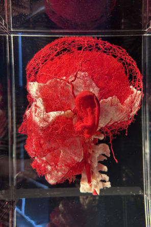 Photo 4 from BODY WORLDS: The Anatomy of Happiness