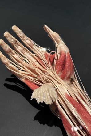 Photo 6 from BODY WORLDS: The Anatomy of Happiness