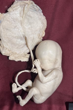 Photo 7 from BODY WORLDS: The Anatomy of Happiness