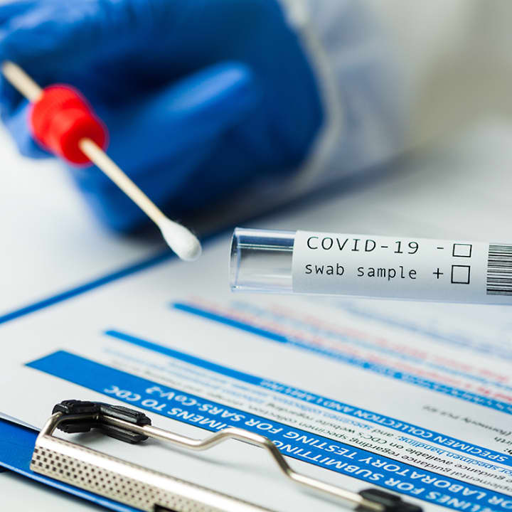 Test COVID-19: Antígenos, PCR y más en la clínica Blue Healthcare